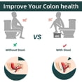 thumbnail image 3 of Foldable Toilet Stool, 7inches Healthy Bathroom Squatting Posture Poop Stool with Anti-Slip Feet, A Good Helper to Effective Relief of Constipation, Easy to Storage Toilet Squat Stool., 3 of 5