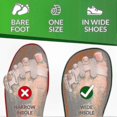 thumbnail image 4 of Yogamedic Silicone Toe Separators for Overlapping Toes, Bunion Relief and Alignment, 6-Pack, BPA-Free, One Size, Comfortable Stretching and Relaxation, 4 of 5