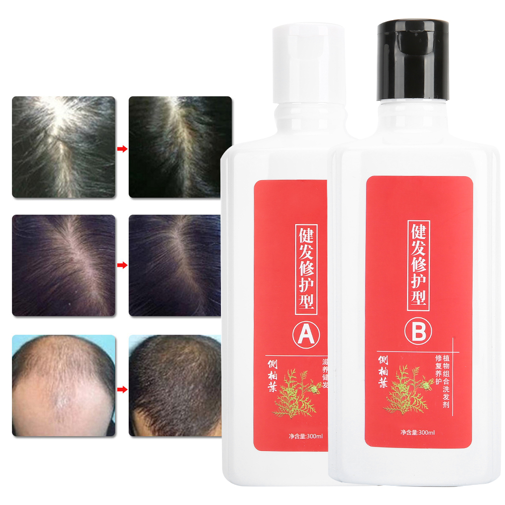 AntiHair Loss Shampoo, Shampoo, Prevent Hair Loss For The