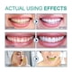 thumbnail image 5 of Whitening Pulling Oil, To Smell To Tartar Very Well Freshen Breath Oral Health Care For Teeth Teeth Cleaning Fluid, 5 of 5