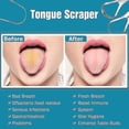 thumbnail image 4 of 3 Pcs Metal Tongue Scraper, Tongue Scrapers For Adults Kids, Stainless Steel Tounge Scrappers, Tounge Scraper Cleaner, Portable Tongue Cleaner, 4 of 5