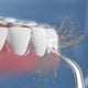 thumbnail image 4 of For Waterpik Water Flosser Waterpik Oral Irrigator Replacement Tips (6 Pack)_lucky_b, 4 of 4