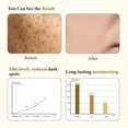 thumbnail image 5 of Pores Dark Spots Cream - Arbutin, Tranexamic Acid, Niacinamide | Targets Spots, Pore Minimizing, Radiant Glow, Gentle Hydrating Formula | Hyperpigmentation Cream for All Skin, 1.76 Fl Oz, 5 of 7