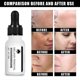 thumbnail image 4 of Lightens Spots Facial Skin Removes Melanin Lightens Freckles Dark Yellow Sun Spots Brightens Skin Tone, 4 of 5