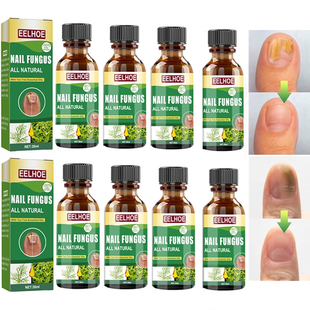 Toenail Fungus Treatment, Effective Nail Fungus Treatment for Toenail