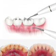 thumbnail image 3 of Plaque Remover For Teeth Teeth Cleaning Kit For Removal Of Food Residue Tartar Oral Care At Home, 3 of 3