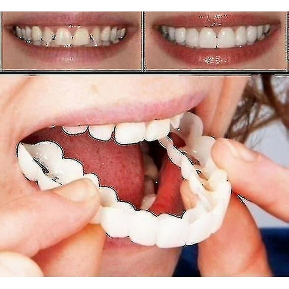A Pair Upper & Lower High Quality Denture Instant Smile Comfort Fit Flex Cosmetic Teeth Denture Teeth Top Cosmetic Veneer