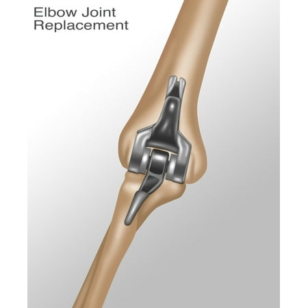 Elbow joint essay picture