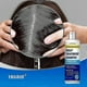 thumbnail image 1 of Ketoconazole Scalp Treatment Shampoo - Anti Dandruff Shampoo - Itchy Scalp Relief, Seborrheic Dermatitis, Folliculitis Treatment, Psoriasis Shampoo -, 1 of 4