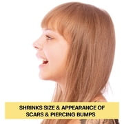 BASE LABORATORIES Piercing Bump Solution & Keloid Bump Removal Soothing Piercing Aftercare for Piercing Bumps & Keloid Scar Remova 0.5 oz