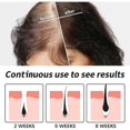 thumbnail image 4 of Hair Dense Hair Essence Repair Dry Hair Moisturizing Hair Root Scalp Dense Hair Essence, 4 of 4