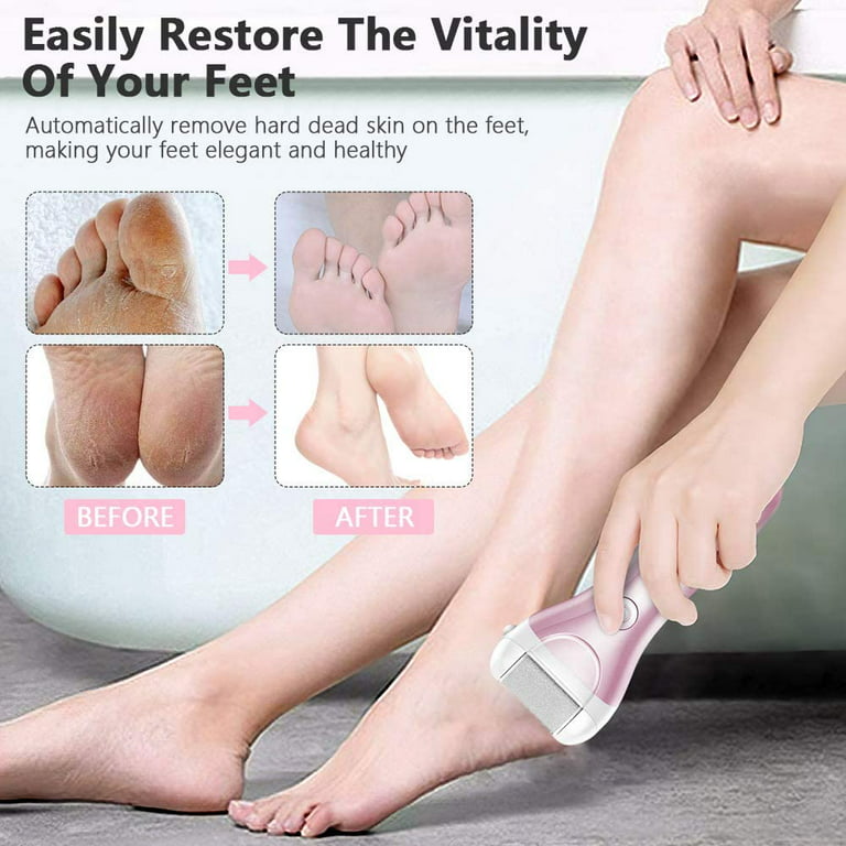Electric Foot Callus Remover Kit, Rechargeable Pedicure Tools Foot Care Feet  File With 3 Heads,2 Speed,battery Display For Remove Cracked Heels Callus