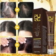 thumbnail image 5 of Crema eficaz para eliminar el acné, tratamiento para el cuidado de manchas de cicatrices de acné, Control de aceite, reducción de poros, blanqueamiento, Gel hidratante antiacné para la cara Feliz Sencillez, 5 of 5