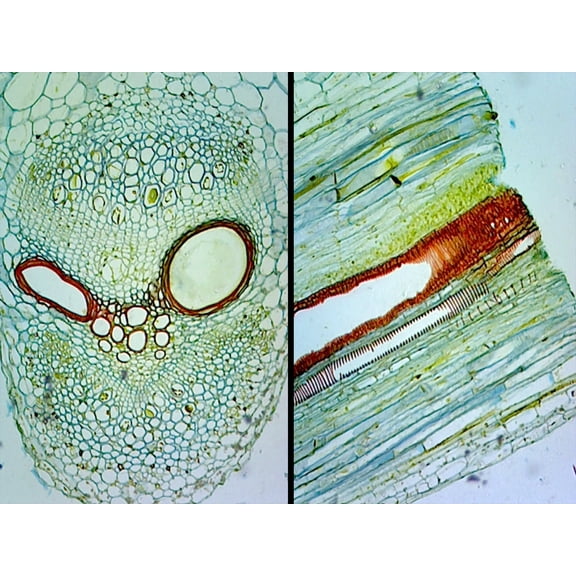 Pumpkin (Cucurbita) Stem; Typical Dicot Stem; Cross Section and Longitudinal Section by Go Science Crazy