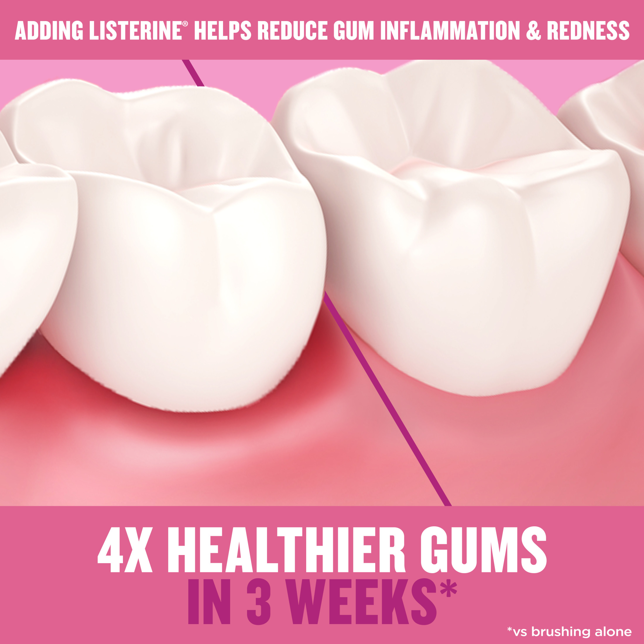 Listerine Gum Therapy Anti-Gingivitis Mouthwash, Glacier Mint, 500 mL - image 5 of 10