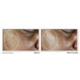 thumbnail image 6 of RoC Multi Correxion Even Tone + Lift Daily Moisturizer SPF 30, 1.7 oz, 6 of 9