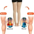 thumbnail image 2 of Shinysix Compression Sock,Socks Men Women Socks Men Women Varicose 1 Pair Socks Pair Socks Men Women Varicose Vein, 2 of 7
