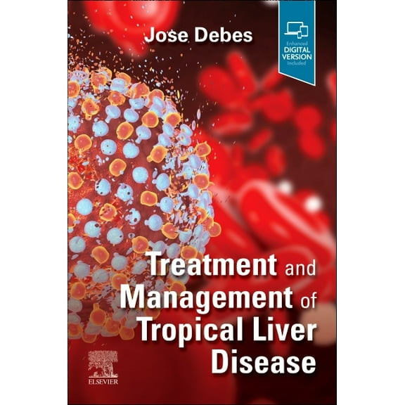 Treatment and Management of Tropical Liver Disease, (Paperback)