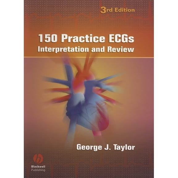 Pre-Owned 150 Practice Ecgs: Interpretation and Review (Spiral-bound) 140510483X 9781405104838
