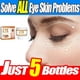 thumbnail image 2 of Suaviza las arrugas, crema rodante para ojos, bolsas para los ojos, ojeras, crema firme antihinchazón debajo de los ojos, hidratante, blanqueamiento, cuidado de la piel, 2 of 5