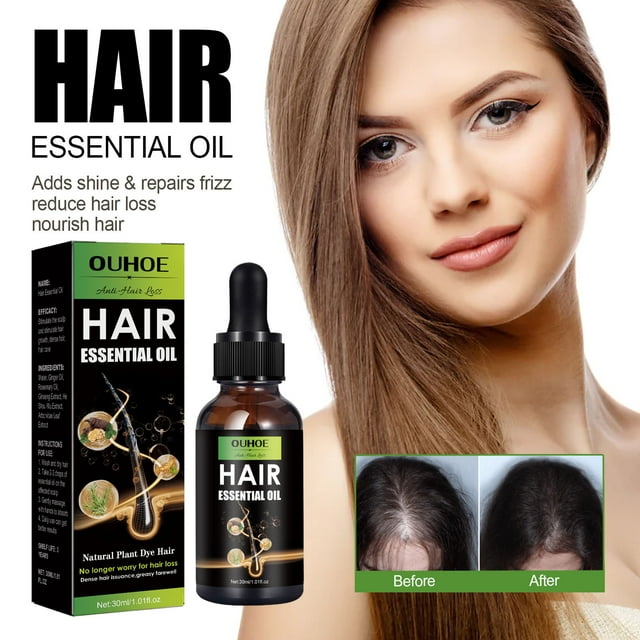 Fiudx Ácido Acético En Crecimiento Del Cabello, Tratamiento Nutritivo Alimentario En Cuero Cabelludo, Suero Anticaída, Fórmula para El Control En La Caspa, para Hombres y Mujeres, Ingredientes Natura