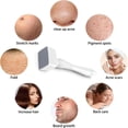 thumbnail image 2 of Precision Facial & Scalp Care Adjustable Micro Needle Derma Roller for Men & Women Enhance Skin, 2 of 8