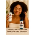 thumbnail image 4 of JewelZ Hair RootZ and Follicles Tea Tree Dry & Itchy Scalp Shampoo, 4 of 4