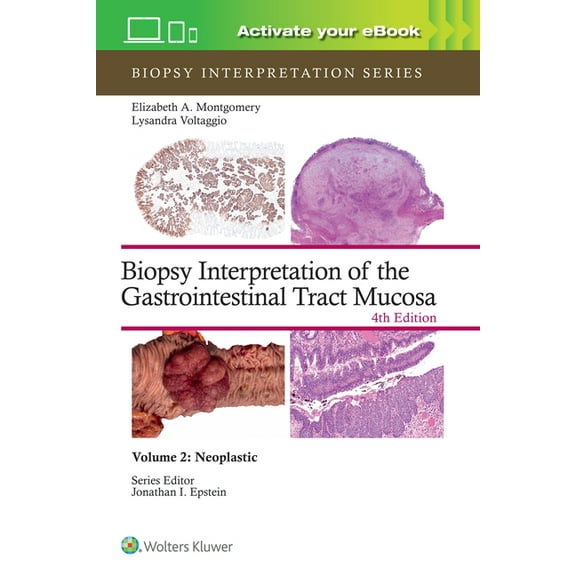 Biopsy Interpretation Biopsy Interpretation of the Gastrointestinal Tract Mucosa Volume 2: Neoplastic: Print   eBook with Multimedia Volume 2, (Hardcover)