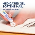 thumbnail image 5 of Dr. Scholl's Ingrown Toenail Pain Reliever & Trimming Kit, 5 of 11