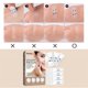 thumbnail image 2 of 120x Adhesivos invisibles para el rostro finos en forma de V para eliminar líneas faciales, arrugas y flacidez de la piel, cinta adhesiva para el mentón y el levantamiento rápido del rostro, 2 of 4