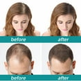 thumbnail image 4 of CYC Multi Peptide Scalp Concentrate 60ml The Original Ordinary Nourish The Roots Concentrate For Men And Women, 4 of 4