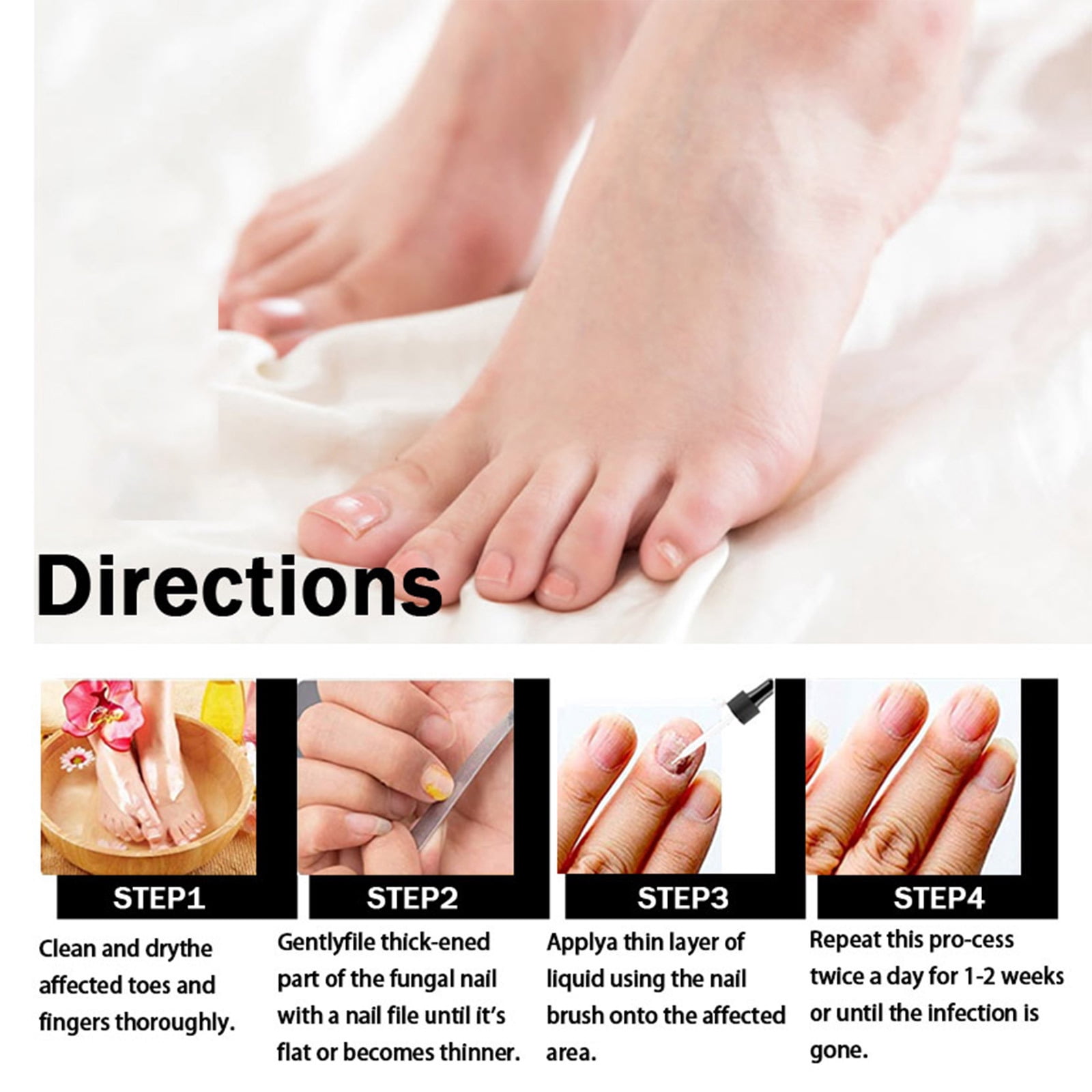 Alvantor Nail Fungus Treatment, Nail Repair Oil Moisturizing and Daily Care, 1fl.oz