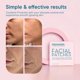 thumbnail image 4 of Parches faciales antiarrugas Frownies, 144 unidades, 4 of 4
