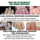 thumbnail image 5 of 7days Nail Treatment, Ginger Nail Treatment, Multi-purpose Nail Repair, Nail Nutrient Oil Strengthener Oil Serum Ginger Nail Growth Oil, 5 of 5