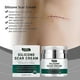 thumbnail image 2 of Advanced Scar Cream, Silicone Gel for Scars, Professional Scar Removal Cream for Surgical Scars, Stretch Marks, Old and New Scars 50G, 2 of 5