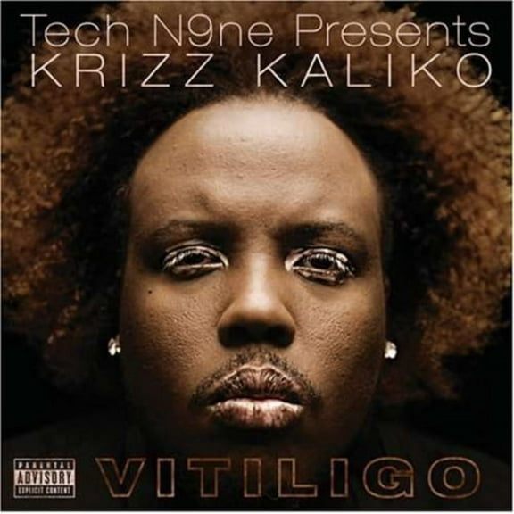 Vitiligo (CD) (explicit)