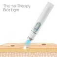 thumbnail image 5 of 1Pcs Home Trea Tment Set Blue Light Varicose Vein Trea Tment Pen, 5 of 6