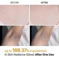 thumbnail image 4 of Peel Shot Keratins Care Kojic Acid Turmeric Exfoliating Spray for Dark Spots Brightening Skin Daily Use, 4 of 5