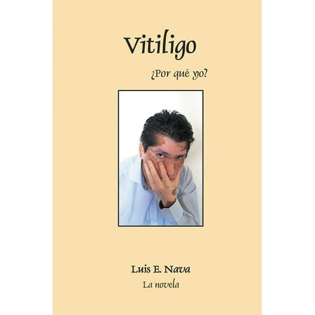 Vitiligo - eBook