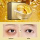 thumbnail image 4 of Mascarilla para Ojos contra Ojeras | Parches de Gel para Ojos para Hinchazón, Arrugas, Hidratación y Alivio | Desinflamador Vegano para Ojos, Almohadillas Hidratantes para el Contorno de Ojos | 1, 4 of 6