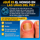 thumbnail image 4 of Fungi-Nail Anti-Fungal Liquid Solution, Kills Toe Fungus and Tolnaftate & Clincially Proven to Cure and Prevent Fungal Infections, 1 Oz (Pack of 1), 4 of 7