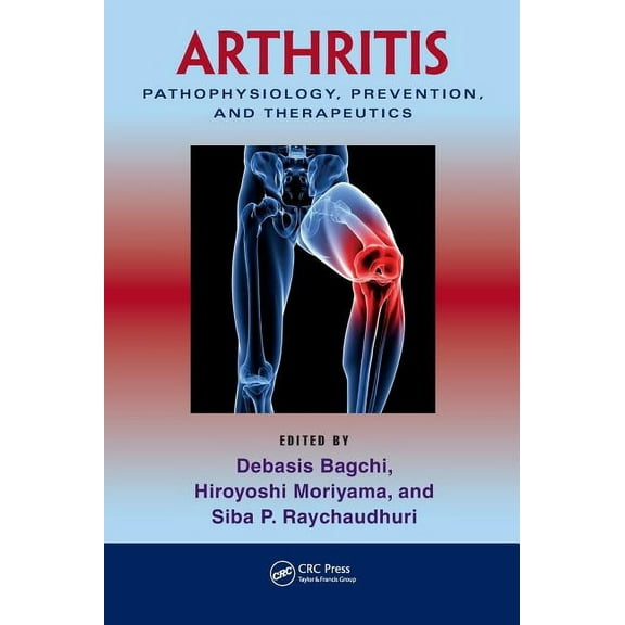 Arthritis: Pathophysiology, Prevention, and Therapeutics, (Hardcover)