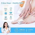 thumbnail image 4 of Nail Fungus Laser Treatment, Anti Fungal Laser-device, Finger Toe Nail Fungus Remover, Onychomycosis, 4 of 5