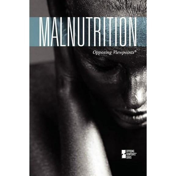 Opposing Viewpoints: Malnutrition (Paperback)