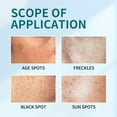 Dark Remover & Pimple Marks Uneven Skin Tone & Removal How to