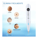 thumbnail image 5 of "Elimina Verrugas Pecas Lunares Mezquinos Tatuajes Belug, Blanca ", 5 of 5