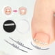 thumbnail image 2 of Herramienta para el Cuidado de los Pies JShteea Corrección de Uñas Encarnadas 2 Uds, 2 of 9