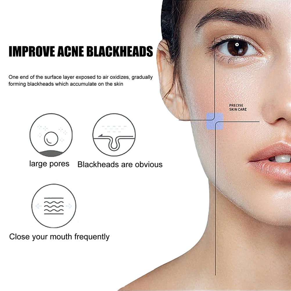 Blackhead Nasal Membranes Nose Strips Pore Deep Cleaning Blackhead ...