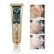 thumbnail image 1 of Crema para eliminar cicatrices quirúrgicas quemadas, Gel que se desvanece, reparación del acné, marcas de viruela, estrías, cicatriz de cesárea brillante, cuidado de la piel suave, 30g, 1 of 5