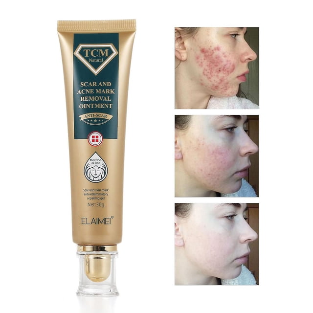 Crema para eliminar cicatrices quirúrgicas quemadas, Gel que se desvanece, reparación del acné, marcas de viruela, estrías, cicatriz de cesárea brillante, cuidado de la piel suave, 30g